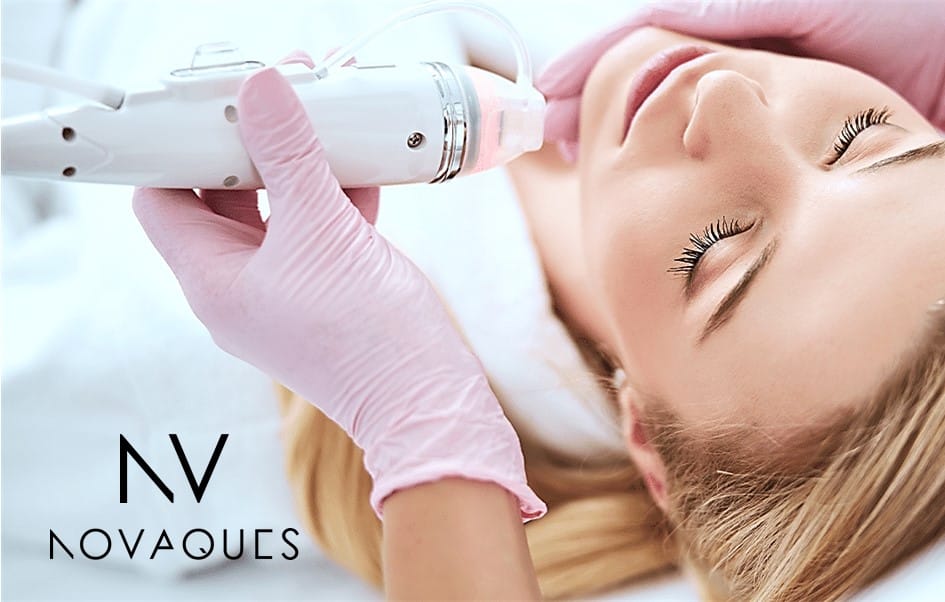 Novaques RF Needling