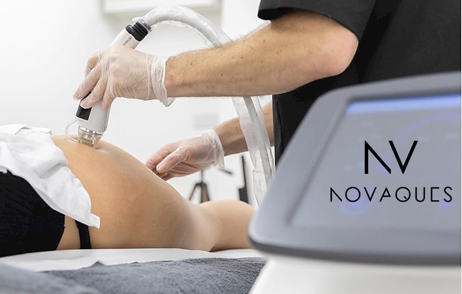 Novaques RF Needling